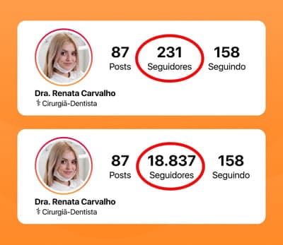 Comparação de perfis: mais seguidores no Instagram gera mais credibilidade