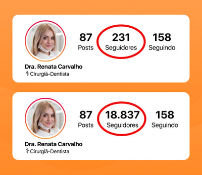 Comparação de perfis: mais seguidores no Instagram gera mais credibilidade